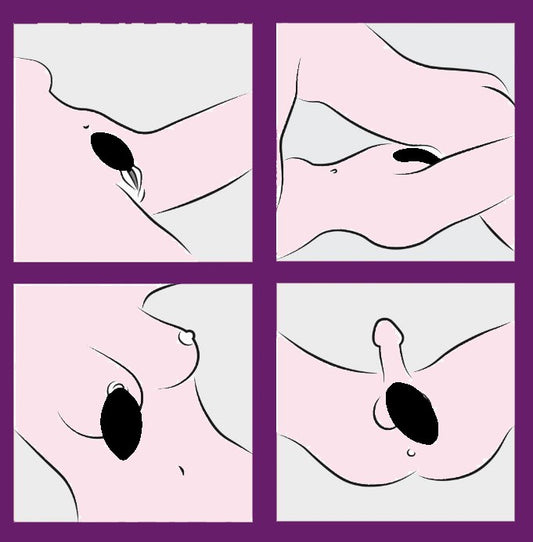 Illustratie met vier gebruiksposities van de Aludra stimulator op het lichaam