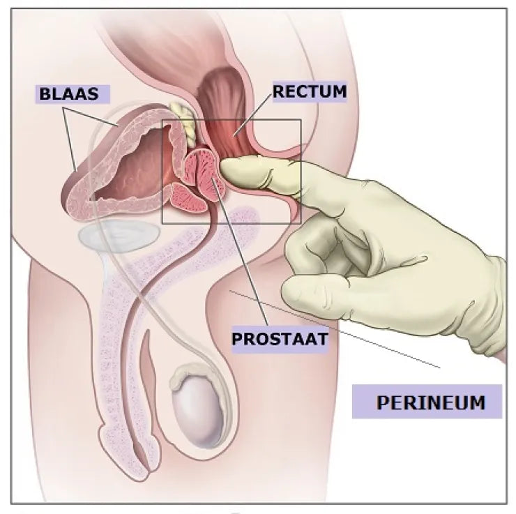 Productfoto bij keuzehulp over prostaat massager gids bij De Paarse Keizerin met eerlijk advies en productoverzicht