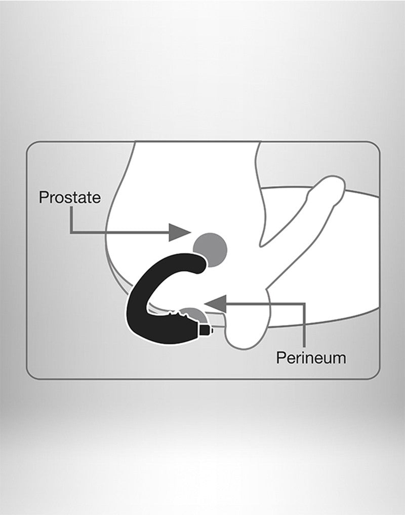 Schematische illustratie van de werking van de Rude-Boy op prostaat en perineum